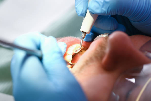 Best Pediatric Emergency Dentist in Bluffton, OH