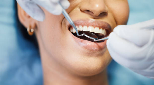 Best Emergency Root Canal Treatment in Bluffton, OH
