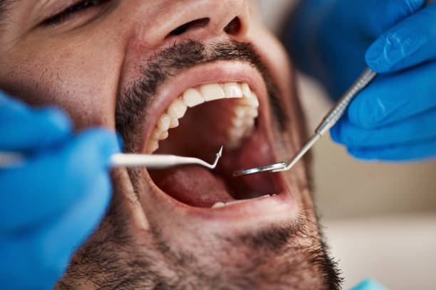 Best Emergency Treatment for Dental Infections or Abscesses in Bluffton, OH